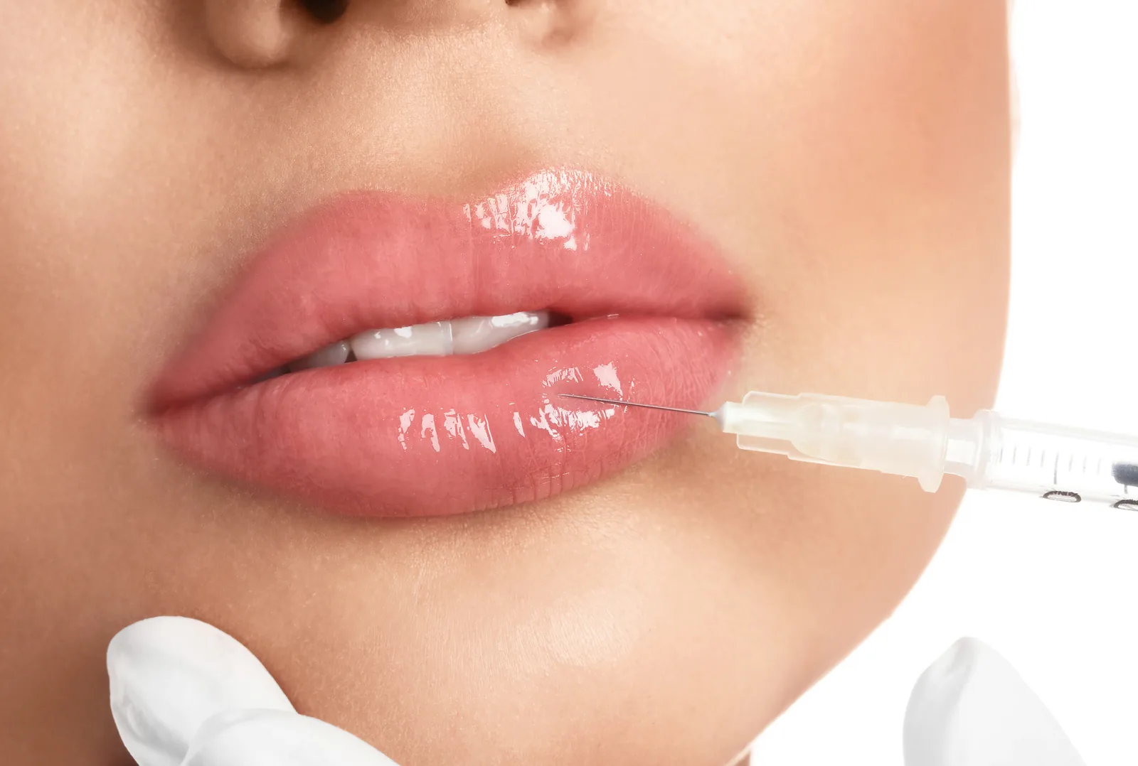 Dermal Fillers & Biostimulators